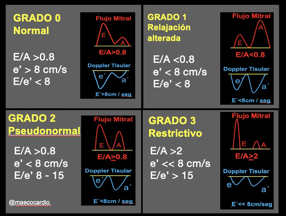 Grados de Disfunción diastólica :Flujo mitral y DTI anillo .Para los que empiezan