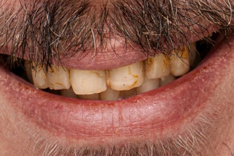 luisingermanico's tweet photo. 🤢🤮

Alguien puede imaginarse a este tipo representándonos ante el Mandatario de China, Alemania o Rusia?

Casi 8 millones gana Kaiser que no alcanzan para dentista ni barbería. https://t.co/ASwOwA7AOC