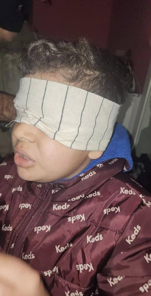 AbujomaaGaza's tweet photo. Last night, Israeli occupation forces kidnapped and abused this Palestinian boy in the town of Kafr Eddeek, in the central occupied West Bank! https://t.co/xlji3Z7yjx