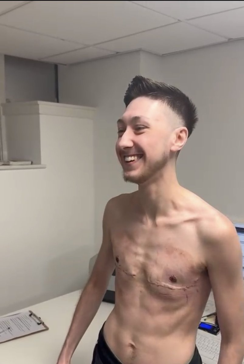 Tristan Simmonds tweet media