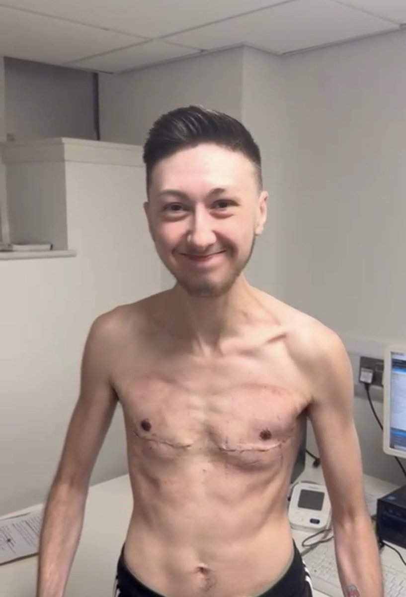 Tristan Simmonds tweet media