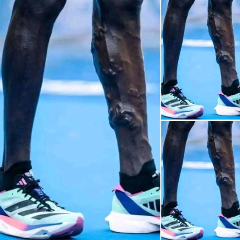 AfricanHub_'s tweet photo. The legs of Kenyan 🇰🇪 athletes Victor Kipruto and Charles Matata after the 21k Zurich Rock 'n' Roll Running Series Madrid. They finished at positions 1 and 2. https://t.co/W11DqofmcE
