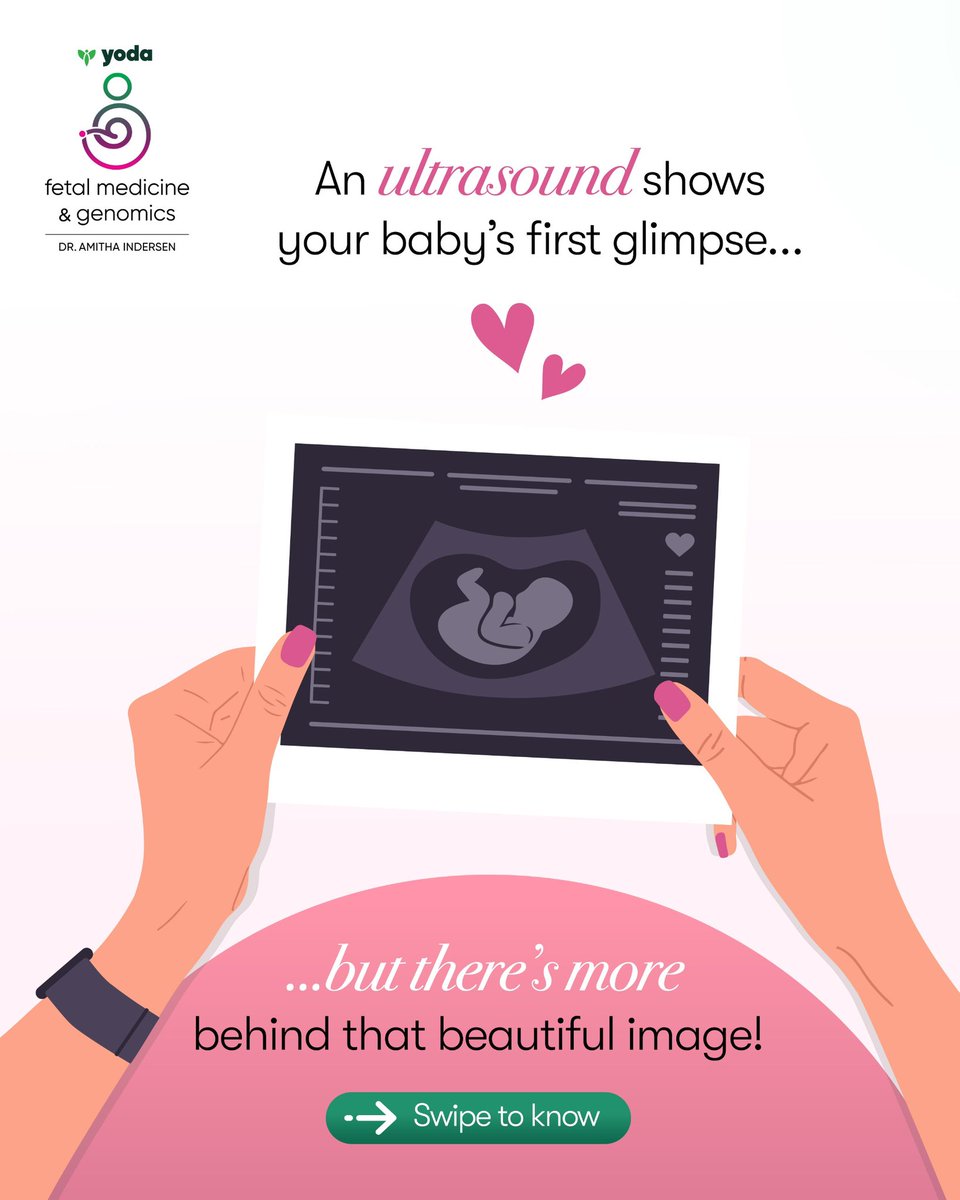 YodaFetalMed's tweet image. Standard ultrasounds are important, but they don’t evaluate critical clues about your pregnancy. Prenatal screening takes it a step further, detecting hidden risks 
 like Down syndrome and other genetic conditions. #StartWithAScreening today from Yoda Fetal Medicine &amp;amp; Genomics.