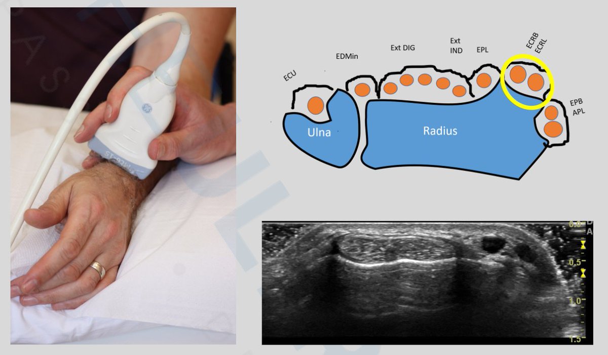 Musculoskeletal ultrasound protocol - The Wrist
FREE PDF
theultrasoundsite.co.uk/wp-content/upl…