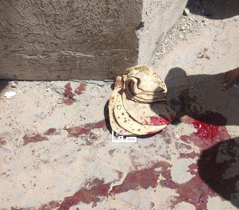 صورة قاسية للغاية

خبز مغمس بالدماء في غزة!!