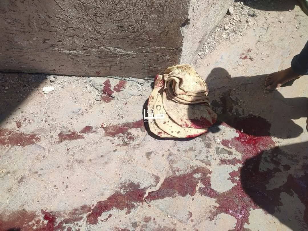 He went home happy carring bread for his family. He got it after a long struggle and his children were waiting for him,  but the their joy wasn't complete.
#A_Bite _Dipped _ in Blood .