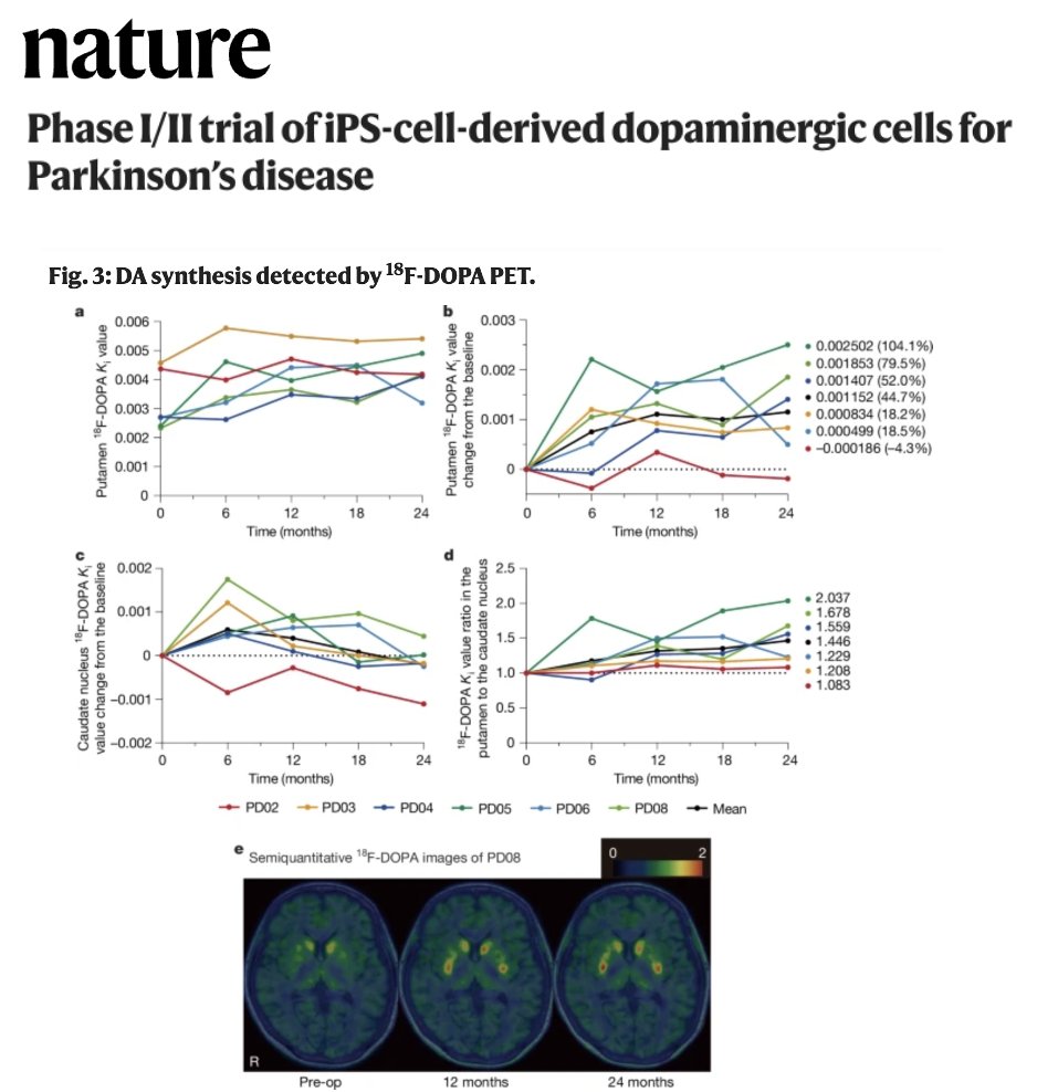 If someone offers to sell you stem cells to treat or cure your Parkinson's, do you know what questions to ask and what documents to collect? Two new studies in Nature this week have reignited the topic of stem cells as a treatment for Parkinson's. Spoiler alert: always ask for