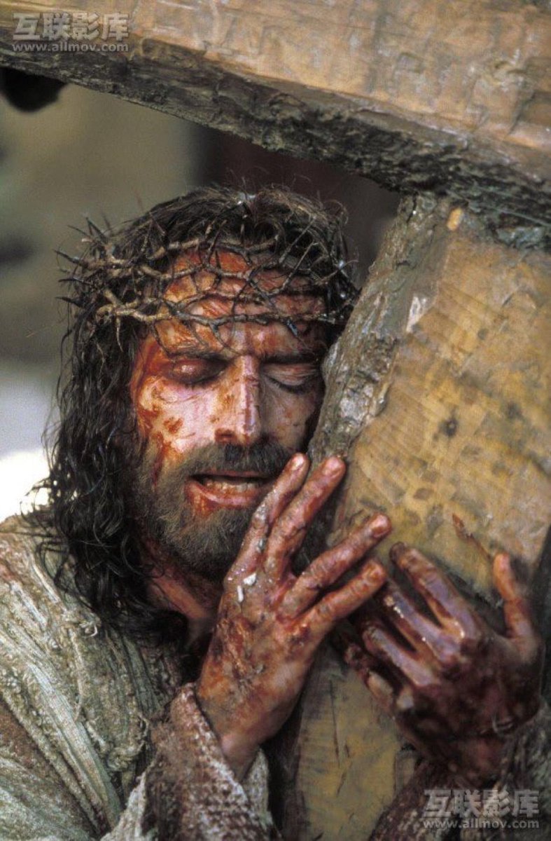 JESUS' SUFFERING &amp; DEATH - A Medical Point of View

Looking into a detailed account of what Jesus went through, it was literally impossible for any man to go through that &amp; be alive within the time frame Jesus went through all that.
But He did that so we all might be redeemed.