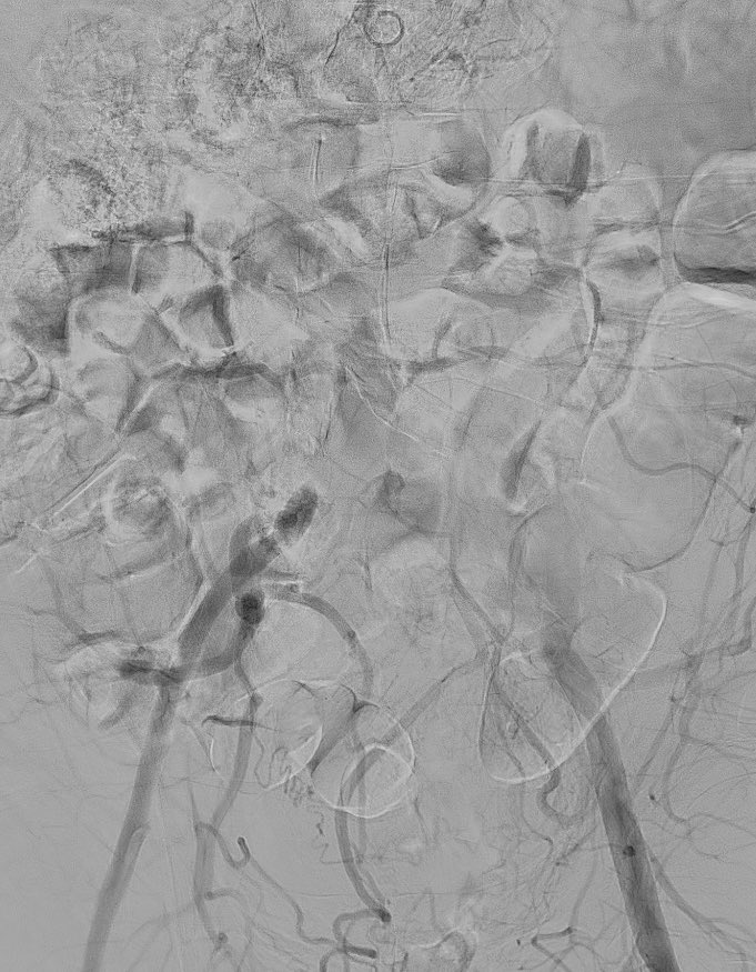 Curious to hear your approach to this case, especially those who generally favor #CERAB