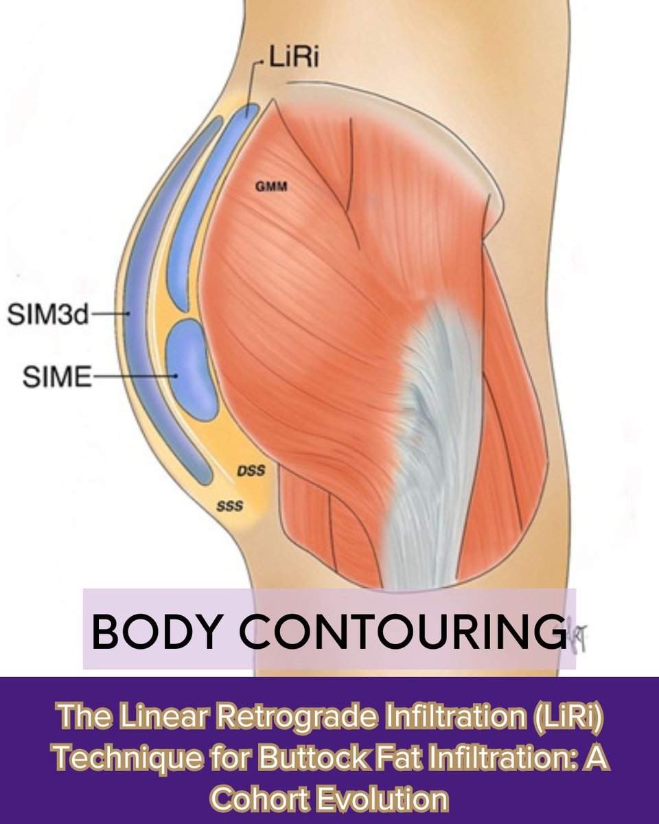 Aesthetic Surgery Journal/ASJ Open Forum tweet media