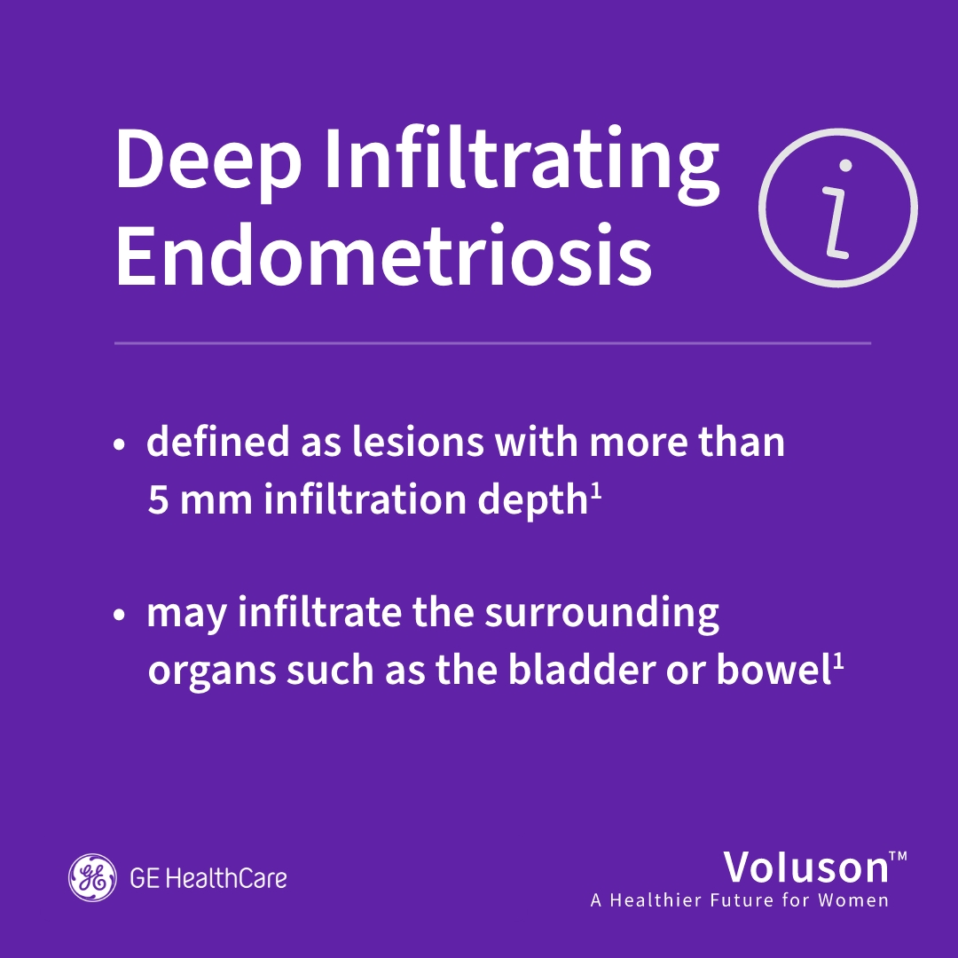 Simon Dennison tweet media