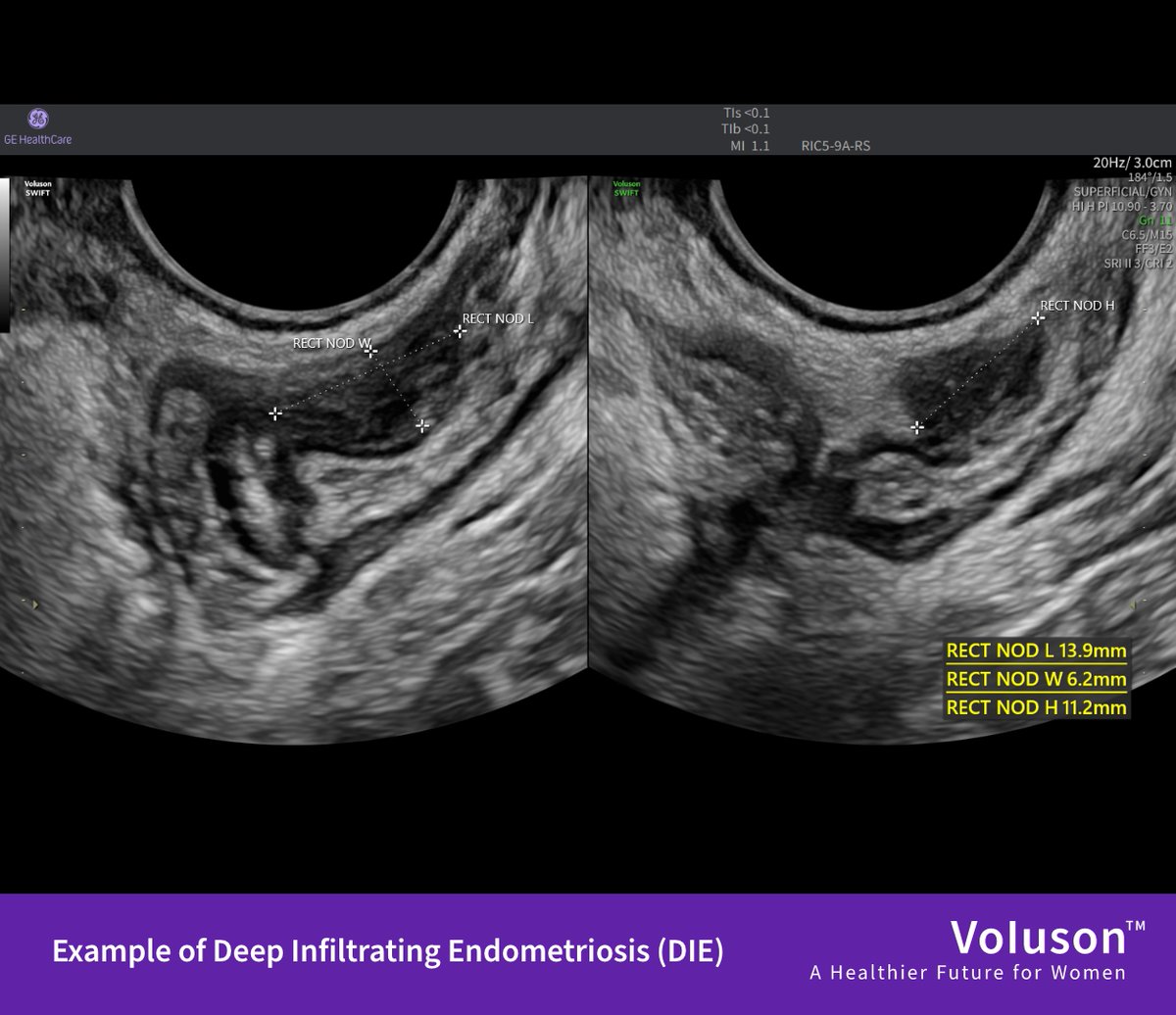 Simon Dennison tweet media