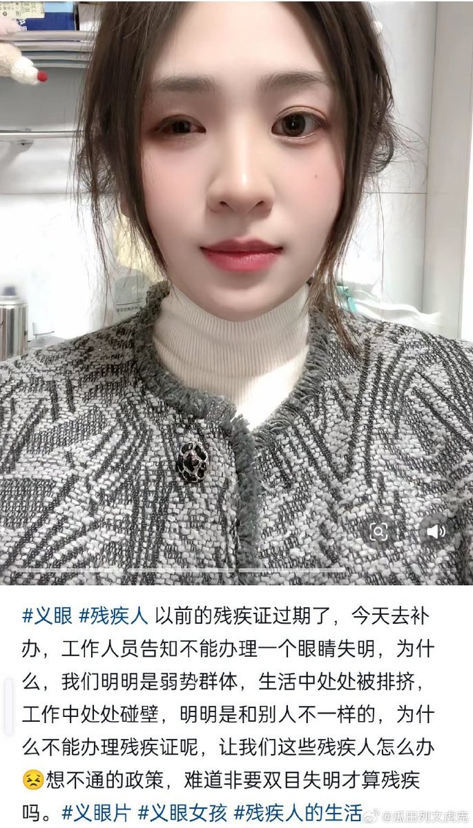 whyyoutouzhele's tweet photo. 来自安徽的张女士，五岁时出车祸被碾压，导致左眼失明，左耳失聪，目前没有收入来源，只能干干农活，并且还遭到丈夫家暴。近日，张女士称她无法办理残疾证。当地残联表示：需要双眼残疾或另一只眼睛视力低于0.3才可办理残疾证，并且有这种情况的还不止张女士一人。 https://t.co/wR118zdUn0