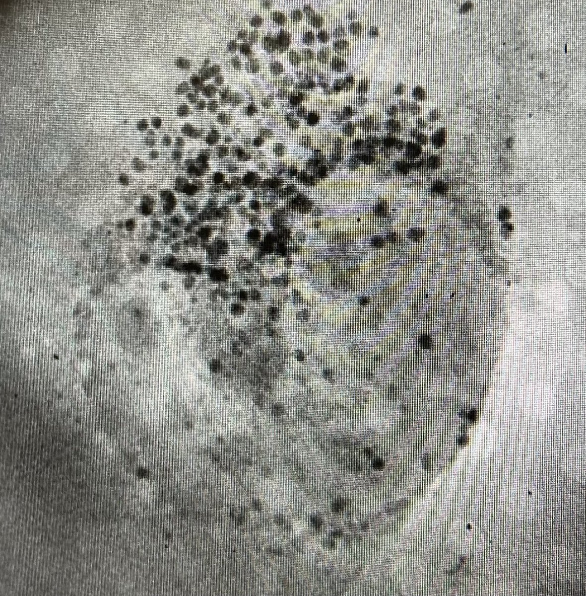 I ❤️ CLEXM. These are two dividing cells imaged on the first lab-based soft x-ray microscope. #SXTFriday #SiriusXT #UCD #MSCA #CLEXM
