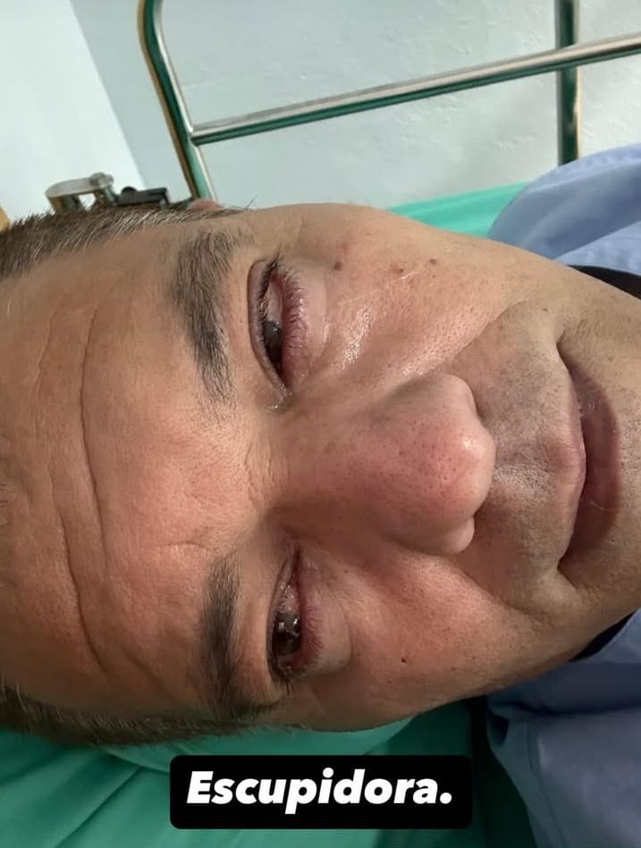 javioliveira's tweet image. #ÚLTIMAHORA | Frank Cuesta se encuentra en el hospital en estos momentos tras la mordedura de una cobra escupidora.