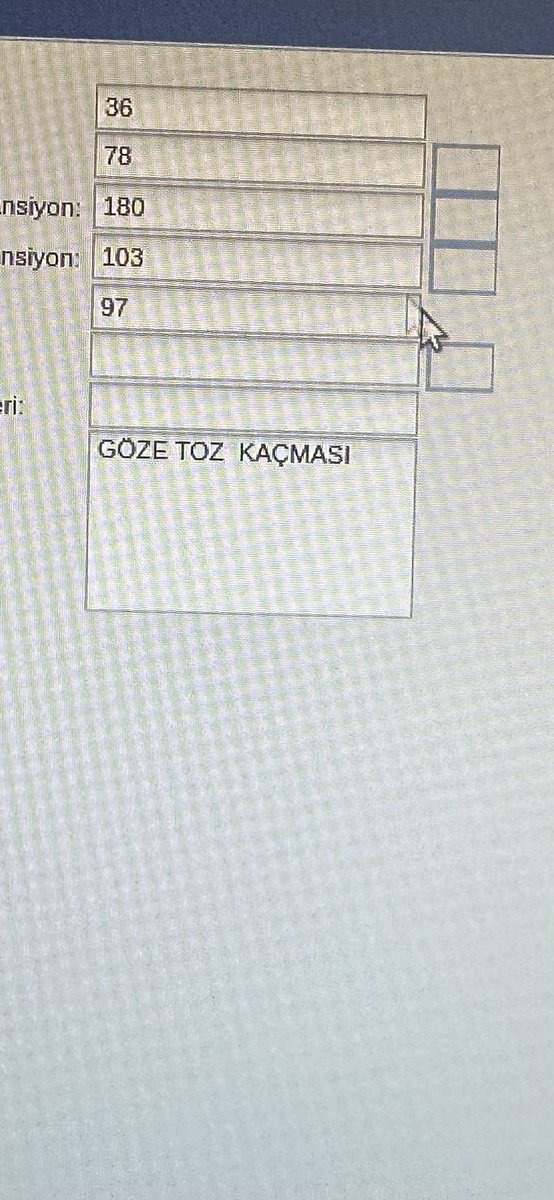 DrEnginEvin's tweet photo. @rojdaaltintas @DrYukselmis @saglikbakanligi Bir de Rojda Hanım ek olarak;demişsiniz ya saatlerce sıra bekliyorlar diye , birkaç örnek verecegim size saatlerce sıra neden bekledikleri ile alakalı,ve bir dr gün içinde 400-500.Hastasına bakarken böyle şeyler ile hasta gelince,bazen malesef dr adına da istemedigi tepkiler olyr https://t.co/yYheLpWI3N