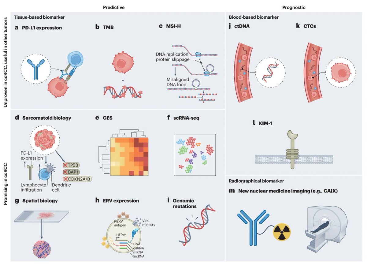 Scott Haake, MD, PhD (@drscotthaake) on Twitter photo Trying to keep up with all the recent @kidneycancer biomarker developments? Check out our new review for all the latest updates. <a href="/brian_rini/">Brian Rini, MD</a> <a href="/VUMCDiscoveries/">Vanderbilt University Medical Center</a>
pubmed.ncbi.nlm.nih.gov/40240621/ Trying to keep up with all the recent @kidneycancer biomarker developments? Check out our new review for all the latest updates. <a href="/brian_rini/">Brian Rini, MD</a> <a href="/VUMCDiscoveries/">Vanderbilt University Medical Center</a>
pubmed.ncbi.nlm.nih.gov/40240621/