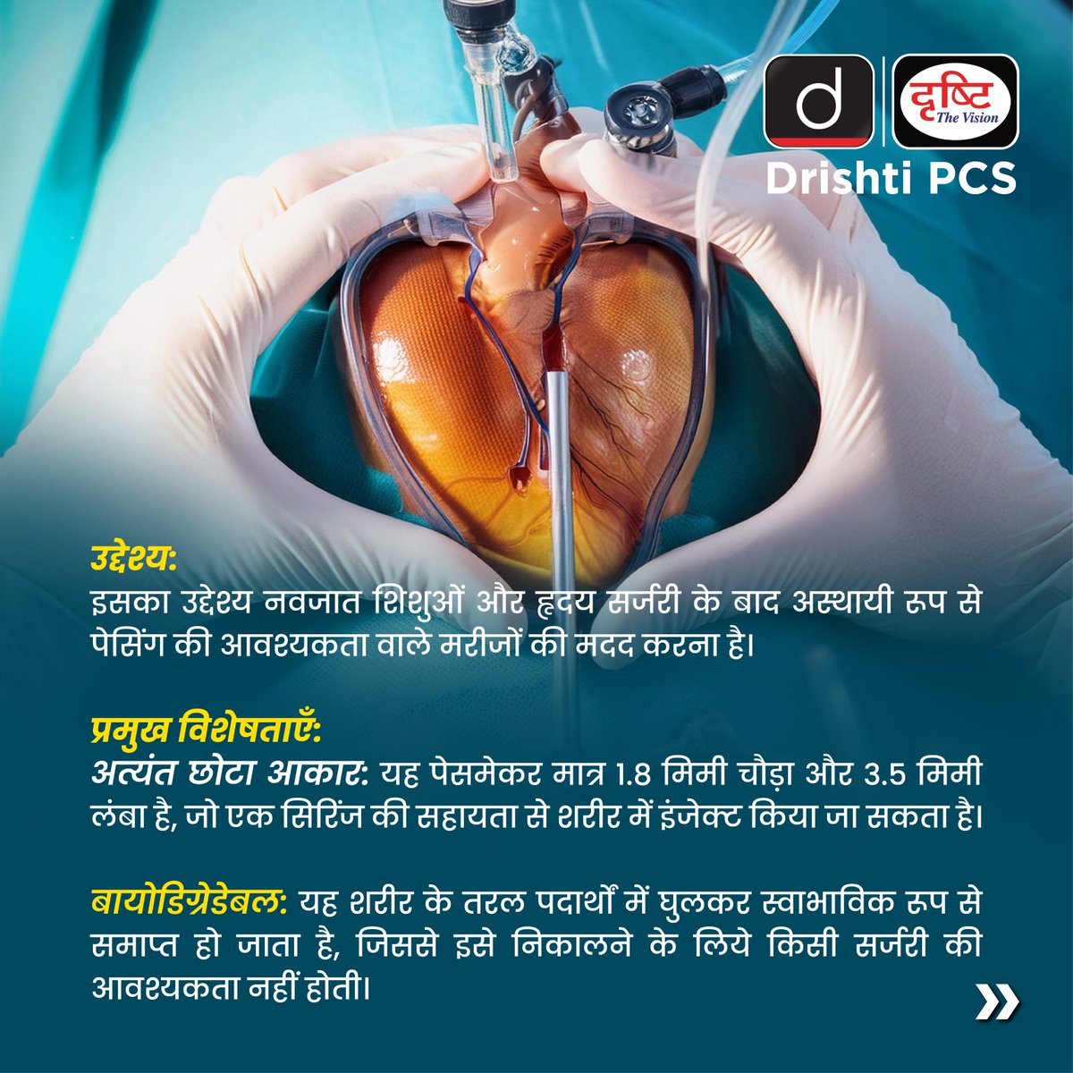 DrishtiPCS's tweet photo. दुनिया का सबसे छोटा पेसमेकर
.
#SmallestPacemaker #MedicalInnovation #HealthcareTechnology #HeartHealth #MedicalBreakthrough #Pacemaker #DrishtiPCS #IAS #PCS https://t.co/RUXgdDe4rT