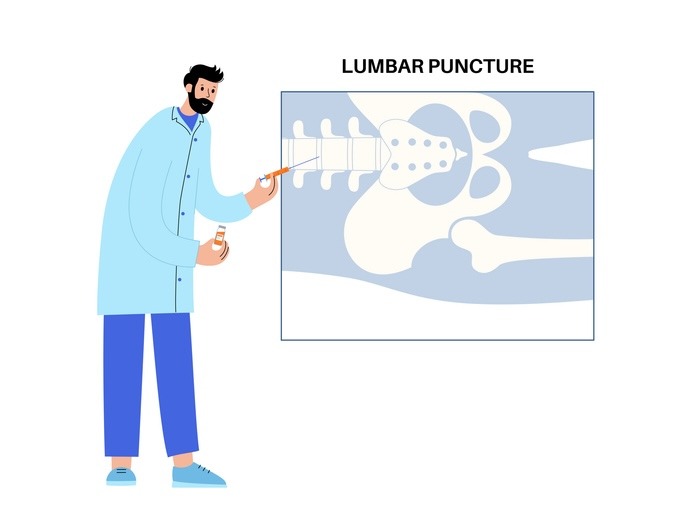 Neurology Today (@neurologytoday) on Twitter photo Neurology trainees face challenges in learning lumbar punctures (LP). Residency directors use simulator training, LP clinics, and bedside ultrasound devices to improve success. <a href="/UHhospitals/">University Hospitals</a> @AANMember #NeuroTwitter
hubs.la/Q03hNF4M0 Neurology trainees face challenges in learning lumbar punctures (LP). Residency directors use simulator training, LP clinics, and bedside ultrasound devices to improve success. <a href="/UHhospitals/">University Hospitals</a> @AANMember #NeuroTwitter
hubs.la/Q03hNF4M0
