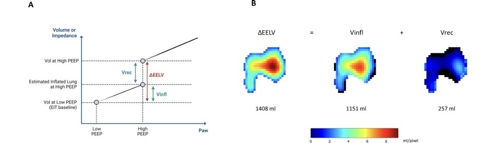 LeslieMegom's tweet photo. 📝El impacto de la PEEP en la presión intracraneal, 🧠💥 la oxigenación en pacientes con lesión cerebral aguda durante la ventilación mecánica.🪭🫁
▪️El uso de presión positiva al final de la espiración mejora la oxigenación y recluta alvéolos, aunque también provoca alteraciones hemodinámicas e incrementa la presión intracraneal.
▪️El síndrome de dificultad respiratoria aguda (SDRA) se desarrolla con frecuencia en pacientes que sufren una lesión cerebral aguda y grave
 📝 Notas cafeteras ☕ 
▪️🧠Los investigadores han postulado varios mecanismos para explicar la relación interdependiente entre la PEEP y la PIC.
▪️ Caricato y Cols demostraron que la hemodinámia cerebral y la PIC no fueron influenciadas por la aplicación de PEEP en pacientes con ⏭️baja compliancia pulmonar (<45 mL/cm H2O )  estos pacientes estaban "protegidos" de mayores aumentos de la PIC⏫🧠 cuando se aplicaban niveles más altos de PEEP porque los pulmones CON MENOR COMPLIANCE  no transmitían⚠️ eficazmente la presión aumentada a todo el espacio intratorácico. 
▪️🧠]. Frost demostró que la aplicación de PEEP entre 5 y 12 cm H 2 O (e incluso transitoriamente hasta 40 cm H 2 O) mejoró la oxigenación arterial☝🏻🤓 sin aumentar la PIC, mientras que Shapiro informó un aumento de >10 mmHg en la PIC en más del 50 % de su cohorte cuando se aplicó PEEP en el rango de 4 a 8 cm H 2 O.
▪️☕Los análisis univariados indicaron que por cada centímetro de aumento de H₂O en la PEEP, los pacientes sin lesión pulmonar aguda experimentaron un aumento de 0,14 mmHg en la PIC.
▪️🧠la PEEP puede aplicarse potencialmente de forma segura AJUSTADA A LAS CONDICIONES de cada paciente, se enfatiza la necesidad de personalizar los ajustes del ventilador para considerar la interacción entre los sistemas nervioso central, respiratorio y cardiovascular.
🧠CONSIDERACIONES IMPORTANTES:
▪️☕La respuesta intracraneal a PEEP depende de la reclutabilidad pulmonar y distribución de gas.
▪️🧠- La oxigenación disminuyó significativamente al reducir PEEP de 14 cmH₂O a 4 cmH₂O.
☕- La presión intracraneal  PI , aumentó de 9 mmHg a 12 mmHg al disminuir PEEP (p < 0.01).
▪️🧠- La presión de perfusión cerebral (CPP) mejoró de 71 mmHg a 75 mmHg (p = 0.03) y la presión arterial media  aumentó de 79 mmHg a 84 mmHg (p < 0.01).
▪️🧠- La relación de reclutamiento (RI) mostró una correlación significativa con el cambio en la PI.
☕- El uso de la maniobra de reclutamiento-inflación (RI) permite evaluar la reclutabilidad pulmonar.
▪️🧠- La tomografía de impedancia eléctrica (EIT) ofrece monitoreo en tiempo real de la distribución regional de la ventilación pulmonar.  
▪️☕- La PaO2 disminuyó de 108 mm Hg a 94 mm Hg al reducir PEEP, mostrando una relación con el RI.
▪️🧠- La compliance estática disminuyó significativamente al pasar de PEEP alto a bajo, afectando a 8 de 10 pacientes.
▪️☕- El índice de inhomogeneidad de EIT mostró una asociación significativa con los cambios en la presión intracraneal (ICP).
▪️🧠PEEP alto puede aumentar la presión intracraneal (PI) al afectar el drenaje venoso cerebral, pero también puede ser seguro al mejorar la oxigenación.
▪️☕- Se observó un aumento en la ΔPaO₂ de 15 ± 10% al cambiar de PEEP alto a bajo, especialmente en pacientes con pulmones más reclutables.
▪️🧠- A PEEP alto, la presión arterial media (MAP) y la presión de perfusión cerebral (CPP) disminuyeron, mientras que la compliance intracraneal aumentó.
▪️☕- La presión venosa central (CVP) superó la ICP a PEEP alto, sugiriendo un impacto negativo en el drenaje venoso cerebral.
▪️🧠- La mecánica pulmonar heterogénea modula el impacto del PEEP en la PI con un aumento en la compliance de 58% y una pérdida de 42% en compliance.
▪️☕- La inhomogeneidad en la distribución de gas fue un factor clave asociado con los cambios en la ICP, destacando la importancia de la distribución del gas en el pulmón.
👇🏻👇🏻👇🏻👇🏻 CONTINUA: