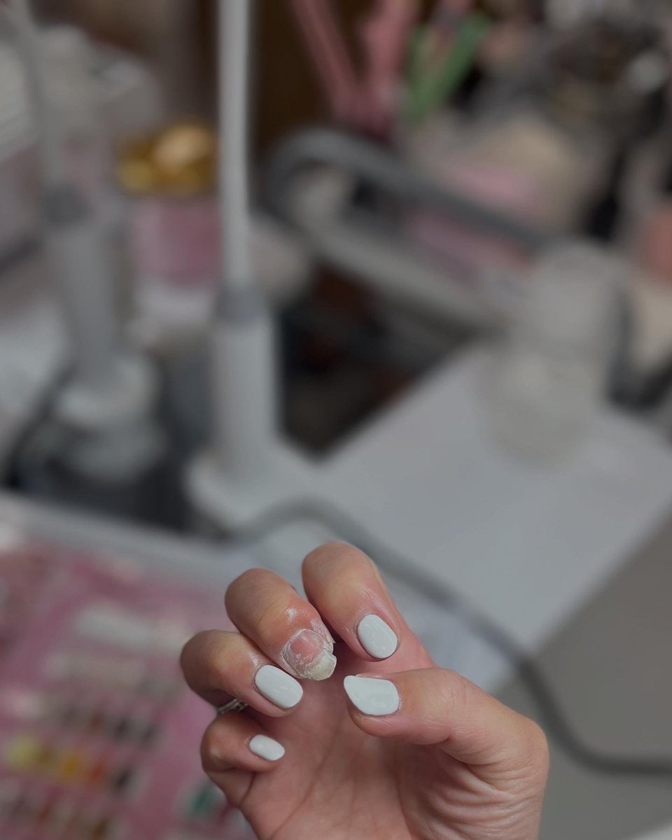 chorolin's tweet photo. #newnails💅 .
AEON系の短時間施術ジェルネイルサロンへ
まだ関東圏にしかないとか
右中指、根元から横に半分以上の亀裂🥹
ネイリストさんも補修するのは厳しいレベルと。爪だしは行っておらず
家で自分でやることに
諦めてざっくり爪切って無理やり爪だしして揃えられました😊
@tomakecute https://t.co/jXuPUnuMQD