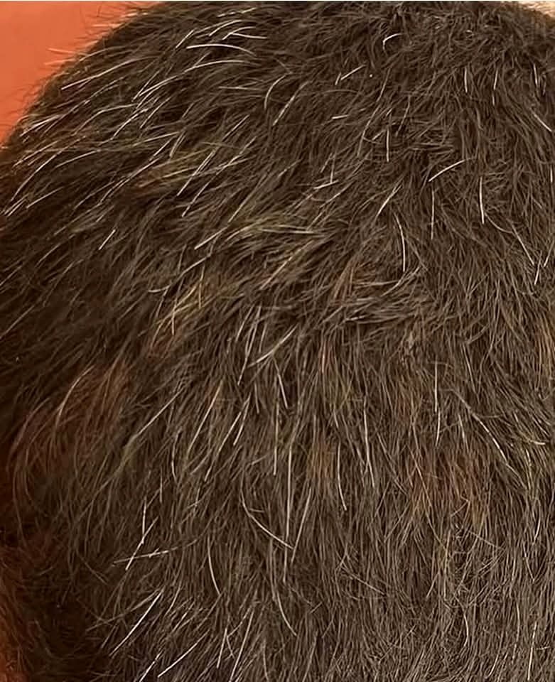 Hair of 12 years old Kid from Gaza..💔