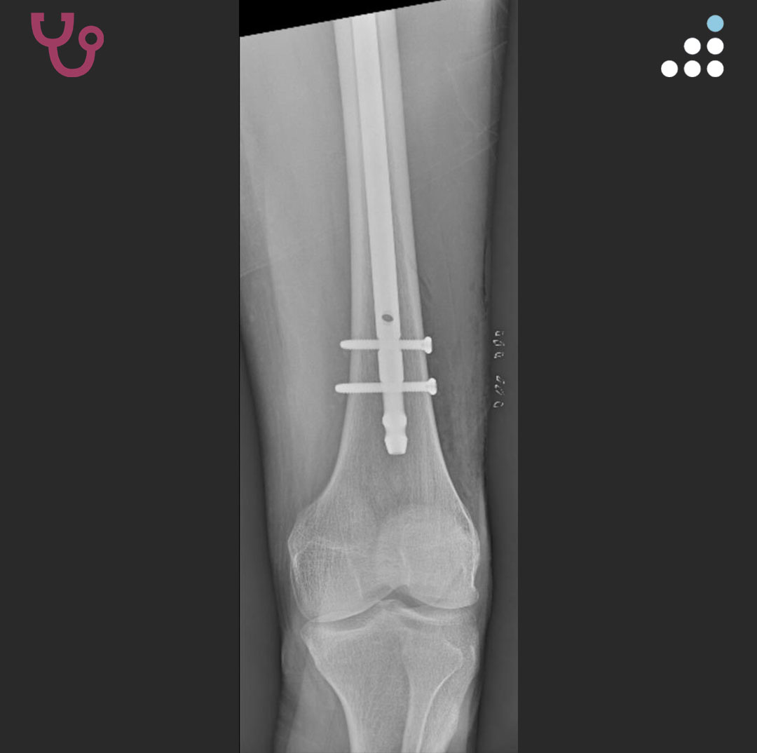 Orthobullets tweet media