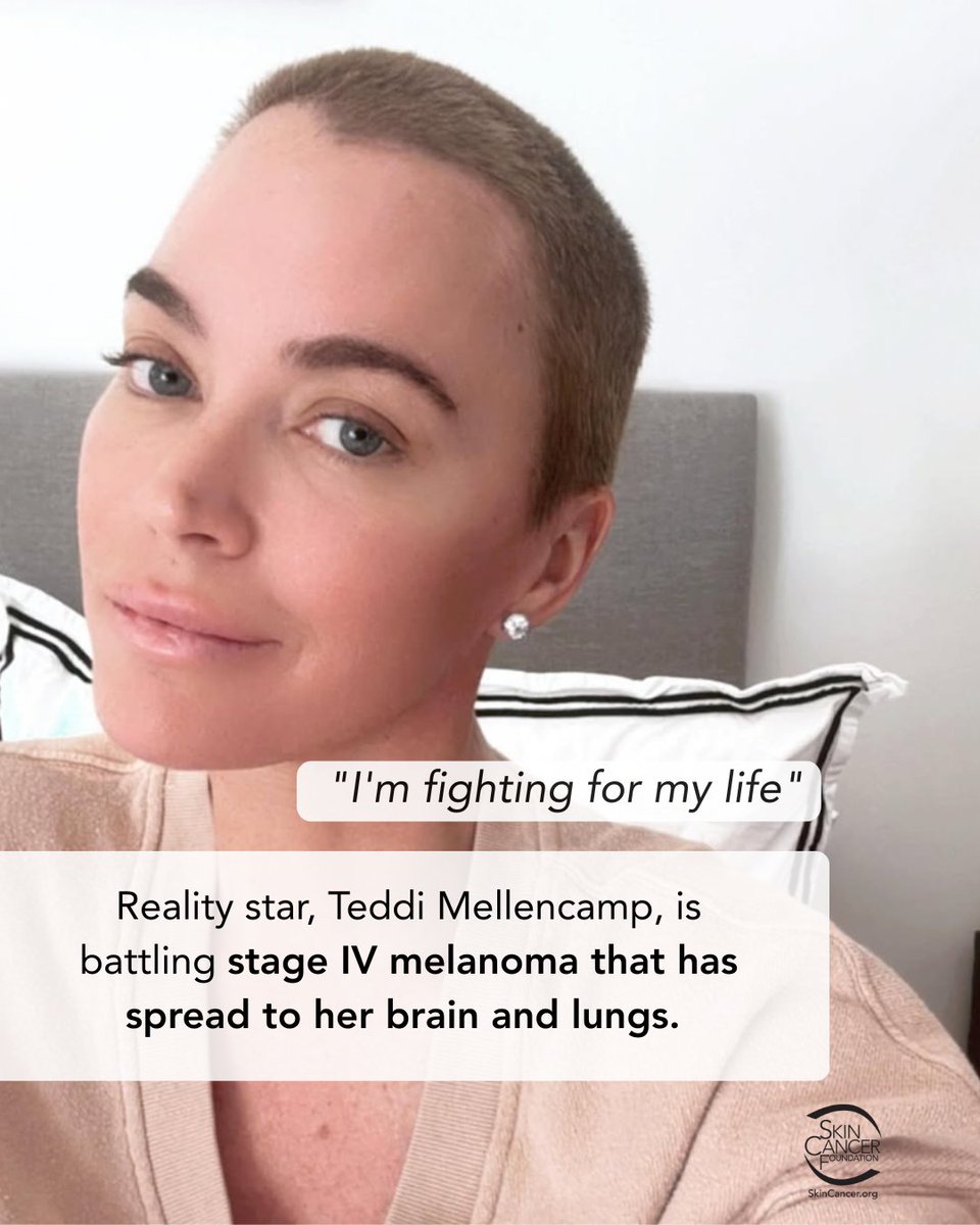 In February 2025, the reality star shared an Instagram post revealing that she would undergo emergency brain surgery to remove multiple tumors. 
 
After her surgery, her doctors told Mellencamp that she had stage IV melanoma that had metastasized to her brain and lungs.