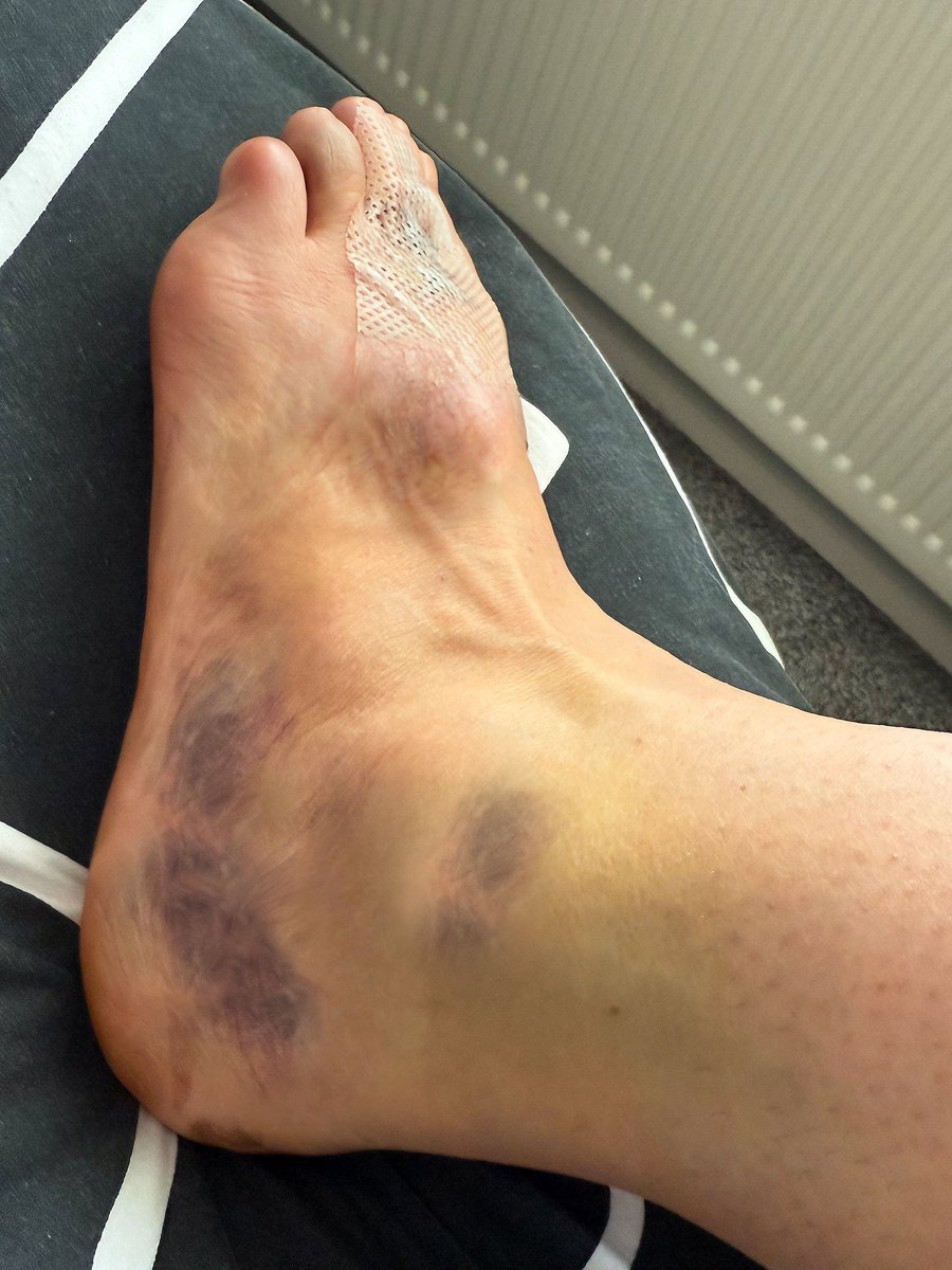 Hannah Ayres tweet media