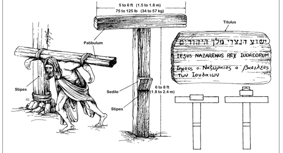 LeonardoSotoMu's tweet photo. De qué murió Jesús de Nazareth:
A) Shock hipovolemico
B) Asfixia 
C) infarto al miocardio
D) otras 
https://t.co/yYsuDglpgo https://t.co/lkrhj5Aa0f