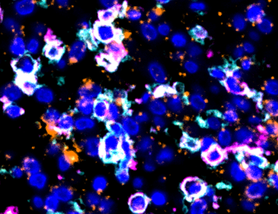 Science Immunology (@sciimmunology) on Twitter photo Researchers have identified a subset of #regulatory #Tcells enriched in the decidua that promote maternal-fetal immune tolerance during early #pregnancy. <a href="/ShandongU/">山东大学 SHANDONG UNIVERSITY</a>
Learn more in Science #Immunology: scim.ag/4cAgw3E Researchers have identified a subset of #regulatory #Tcells enriched in the decidua that promote maternal-fetal immune tolerance during early #pregnancy. <a href="/ShandongU/">山东大学 SHANDONG UNIVERSITY</a>
Learn more in Science #Immunology: scim.ag/4cAgw3E