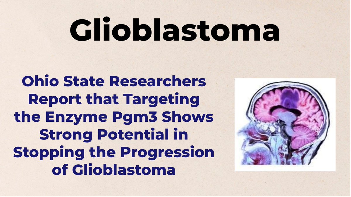 Ohio State Researchers Report that Targeting the Enzyme Pgm3 Shows Strong Potential in Stopping the Progression of Glioblastoma - Check the Link for More  shorturl.at/qKtRL #Glioblastoma  #RareDisease  <a href="/OSUWexMed/">The Ohio State University Wexner Medical Center</a>  #BrainCancer  #GBM  #OrphanDrugs