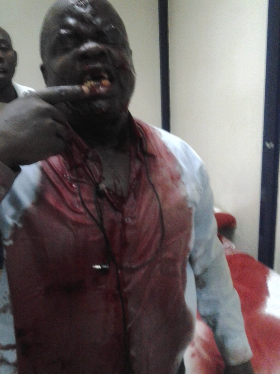 Kibet_bull's tweet photo. Okiya Omtatah has been through all this just for the rule of law. Do not vote for fame over good. https://t.co/FAJyhug3dY