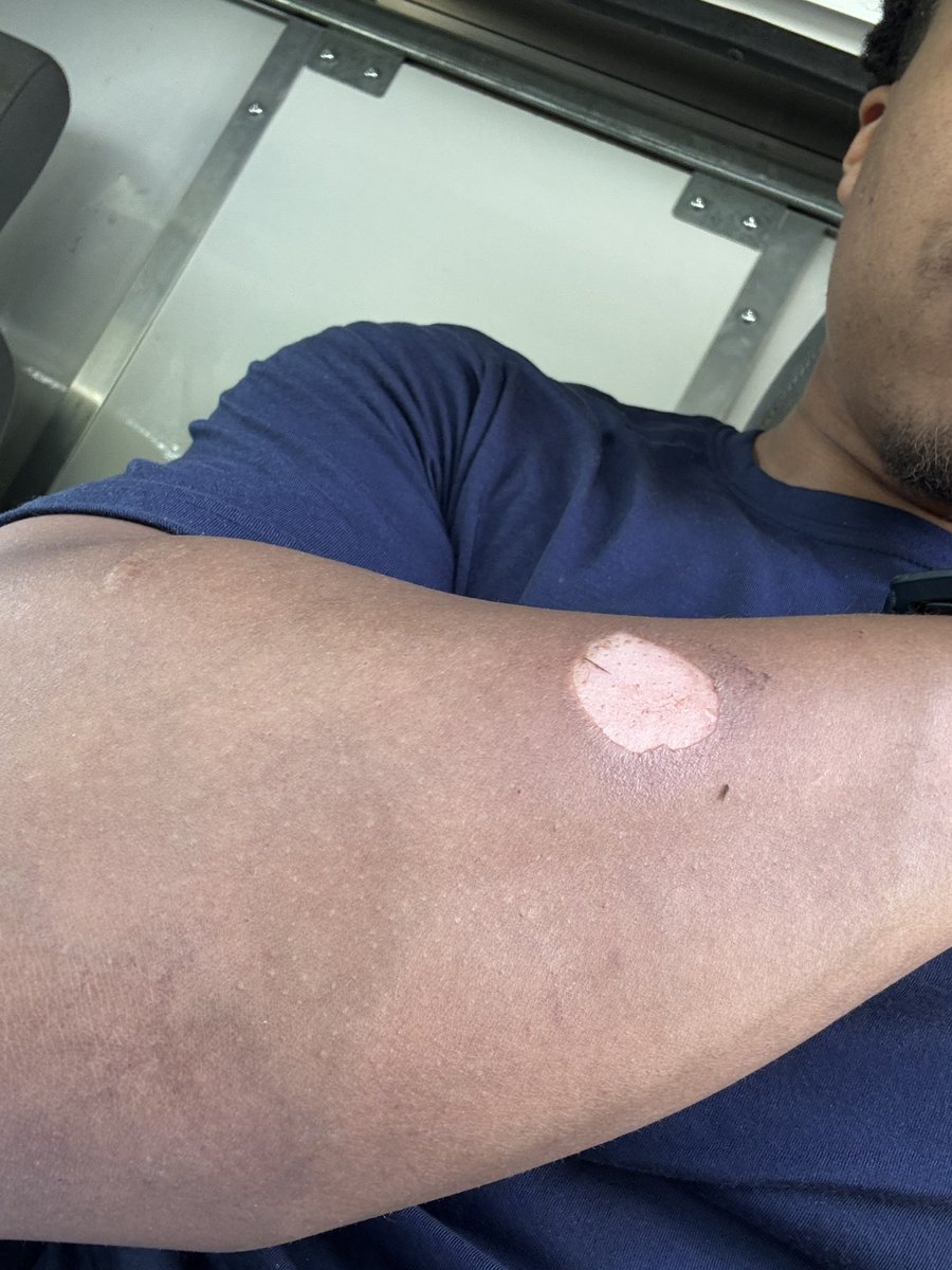 ets_mal's tweet image. Hvac technician furnace/coil install and war wounds😂🗣️