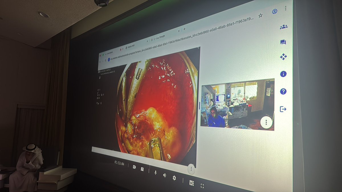 Aymen Almuhaidb, MD أيمن المهيدب (@almuhaidbaymen) on Twitter photo Day 1 #SaudiEndoscopyDays: 500+ attendees; 10 excellent live demos, 11 hands‑on stations workshop for trainee; quiz w/ iPhone prize; live cases from <a href="/NMGastro/">Northwestern Medicine Digestive Health Institute</a> <a href="/gastrowala/">Aziz Aadam</a> <a href="/RKeswaniMD/">RKeswaniMD</a>
See you Day 2 for more live demos & recorded cases!
<a href="/Taalamri/">Turki AlAmri |تُرْكي عبدالله الْعَمريَّ MD</a> <a href="/marianoGHR/">Mariano Gonzalez H</a> <a href="/AntonioFaccior6/">Antonio Facciorusso</a> Day 1 #SaudiEndoscopyDays: 500+ attendees; 10 excellent live demos, 11 hands‑on stations workshop for trainee; quiz w/ iPhone prize; live cases from <a href="/NMGastro/">Northwestern Medicine Digestive Health Institute</a> <a href="/gastrowala/">Aziz Aadam</a> <a href="/RKeswaniMD/">RKeswaniMD</a>
See you Day 2 for more live demos & recorded cases!
<a href="/Taalamri/">Turki AlAmri |تُرْكي عبدالله الْعَمريَّ MD</a> <a href="/marianoGHR/">Mariano Gonzalez H</a> <a href="/AntonioFaccior6/">Antonio Facciorusso</a>