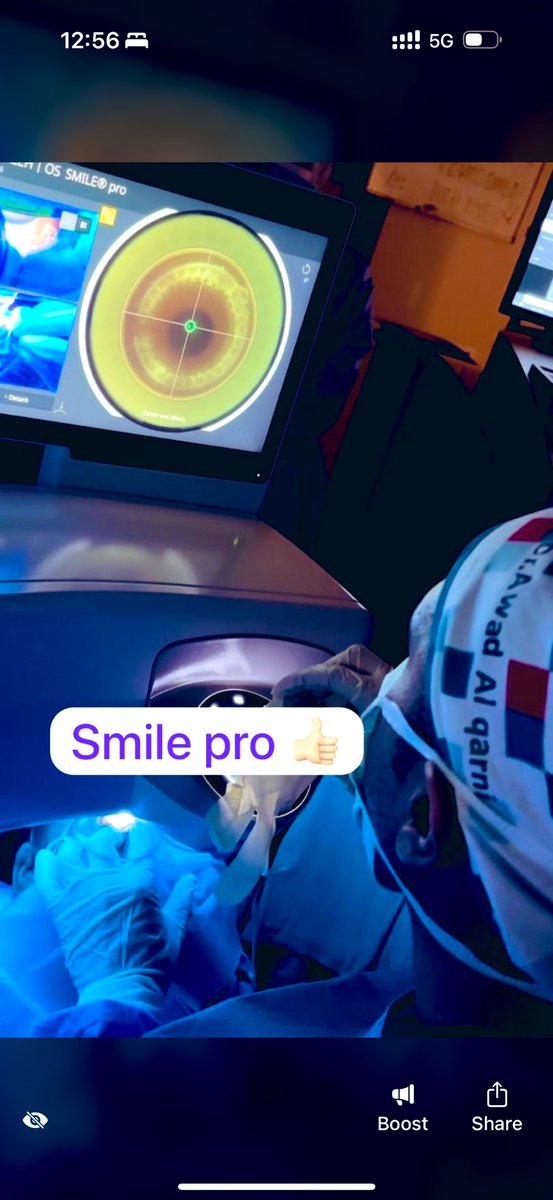 DrAwadQarni's tweet photo. بفضل الله ، أجريت أول عملية تصحيح نظر بتقنية SMILE Pro في مركز مغربي ( طريق المدينه ) بمدينة جده ، وقد حققت العملية نتائج ممتازة ومبشرة.حيث تحسن نظر المريض من أول يوم وتشافى بشكل ممتاز و لله الحمد .
وبذلك يكتمل عقد عمليات تصحيح النظر في المركز ليشمل جميع الخيارات الحديثة: الليزر، الليزك، الفمتوليزك، سمايل برو ، وزراعة العدسات، مما يتيح خيارات أوسع ومرونة أكبر في العناية بمراجعينا وتقديم الحلول الأنسب لكل حالة.