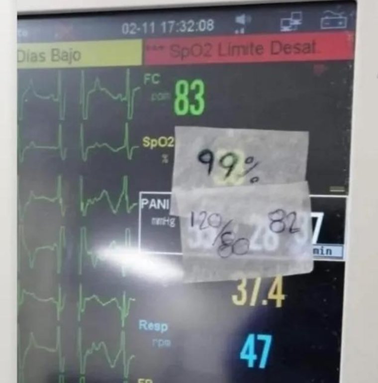 lesperlesdu15's tweet photo. Quand tu veux transférer ton patient de déchoc en service avec comme commentaire : patient stable https://t.co/HtSrYzSJyP
