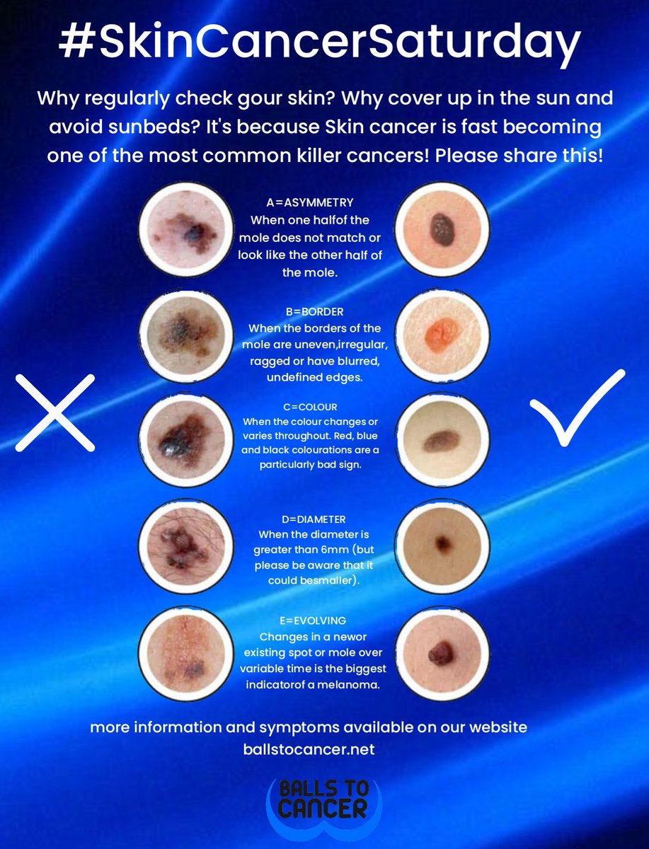 Ballstocancer's tweet photo. It's #SkinCancer Saturday. The weather is warming up, so it's time to be careful in the sun. Sitting in your garden, the beer garden, or just walking around, you need to cover up. You also need to check the moles and marks on your skin and get someone to check your back ! These things have a habit of creeping up on you and small enough to ignore, but please DON'T catching any cancer early increases your chances of survival. More details on our website #Checkit #Getitchecked #moles #cancer #CancerSupportCharity #cancerawareness