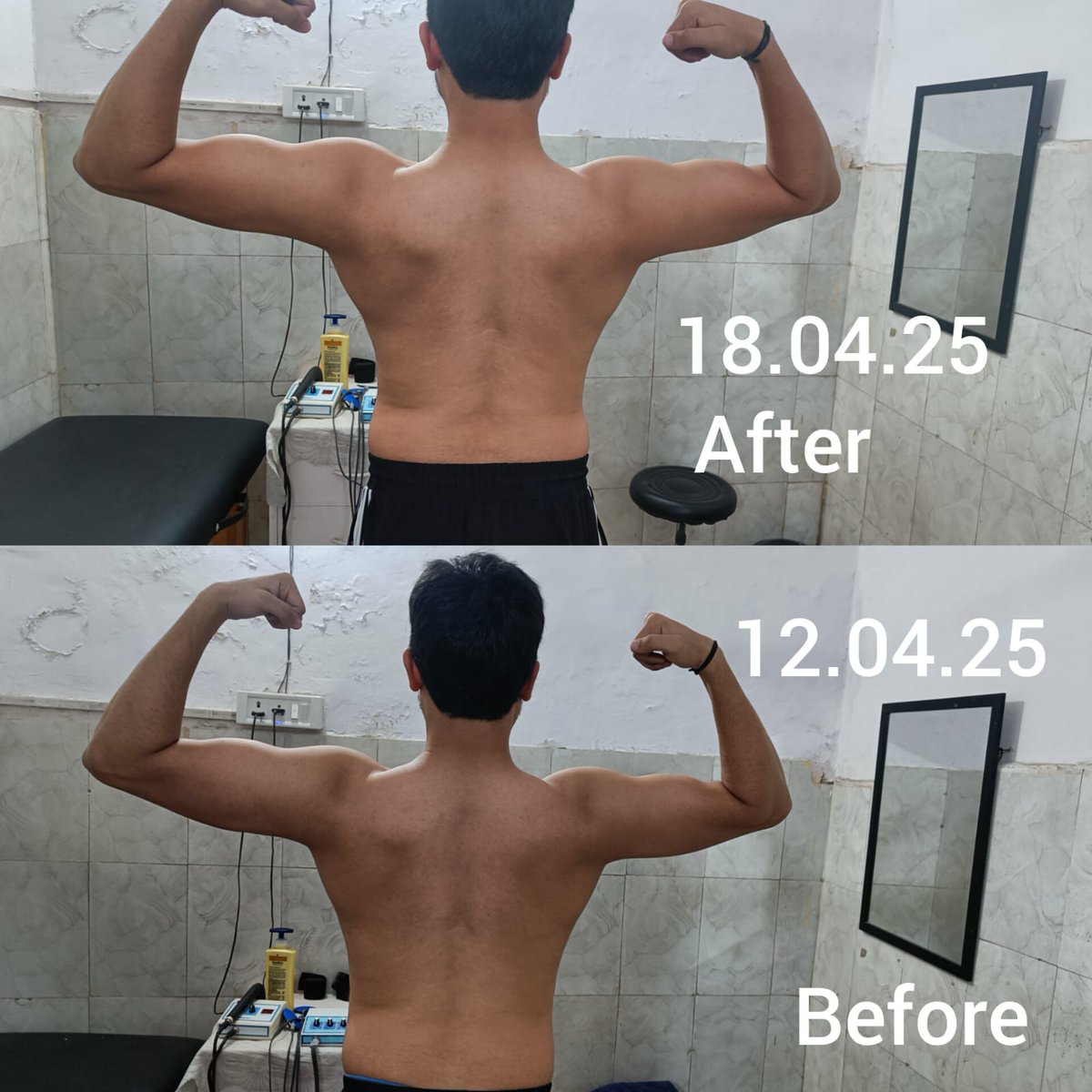 7-Day Transformation.
No, this isn’t about water loss or a lighting trick.
This is structural — alignment, activation, and real correction.
From asymmetry to balance, from dormant to dynamic.
Just another remarkable example of what the human body can do. No food restriction
