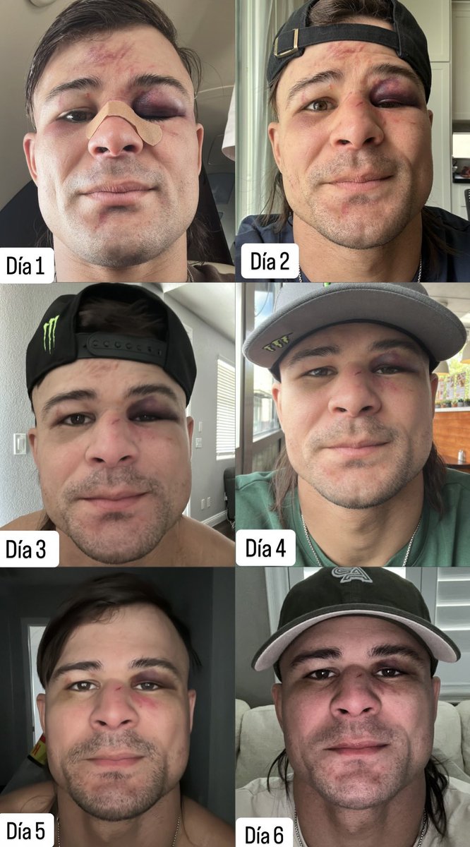 Championship Rounds tweet media