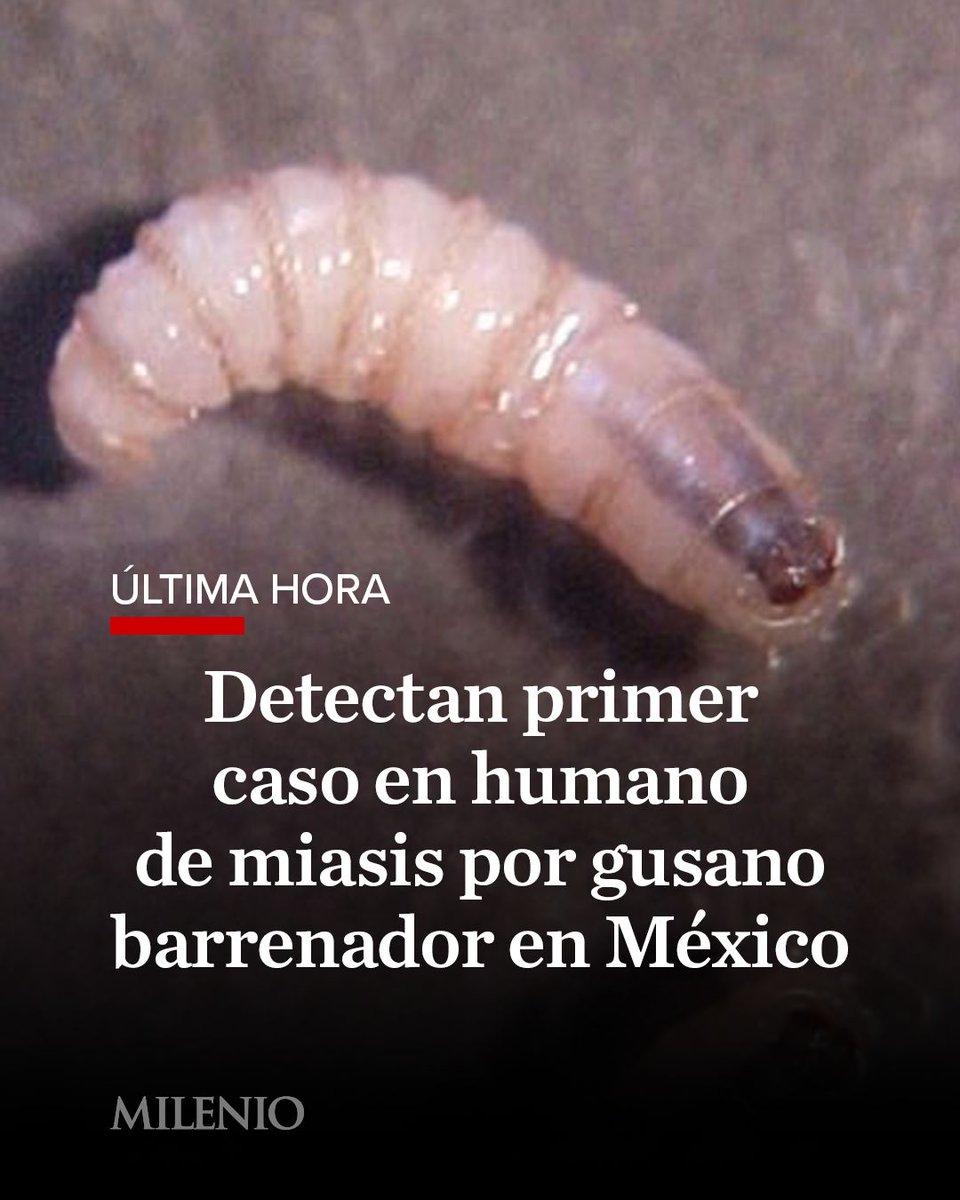 Milenio's tweet photo. 🚨 #ÚLTIMAHORA | Detectaron en México primer caso confirmado en humano de miasis por gusano barrenador del ganado, informó este viernes la Secretaría de Salud

Se trata de una mujer de 77 años de edad, quien vive en el estado de Chiapas. A través de un comunicado compartido en redes sociales, se dio a conocer que la paciente se encuentra estable y recibiendo antibiótico en el Hospital de Alta Especialidad Ciudad Salud de Tapachula.

Esta enfermedad es causada por las larvas de la mosca Cochliomyia hominivorax (Coquerel), que depositan sus huevos en cualquier herida abierta de un animal de sangre caliente, incluidos los humanos. Horas después de la deposición, los gusanos nacen y se alimentan del tejido vivo, lo que puede resultar mortal si no se trata.

🔴 Aquí toda la información https://t.co/cQ8sUDnA9h

#GusanoBarrenador #Miasis #Salud #México #MILENIOInforma #MILENIONoticias