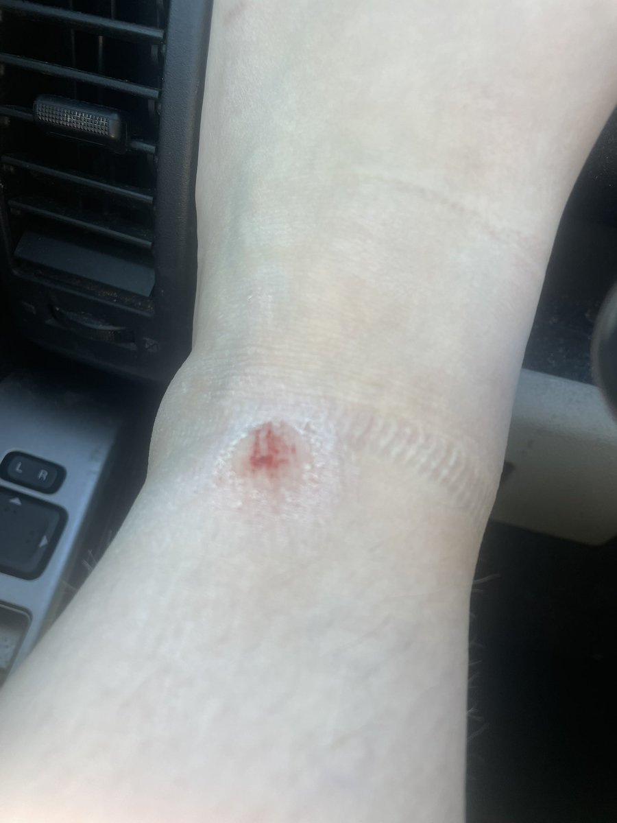 gotojail69's tweet image. #sprained my ankle on Tuesday also it has not been fun over here especially because today I had to run after a child that decided to run into the parking lot today so #prayforme