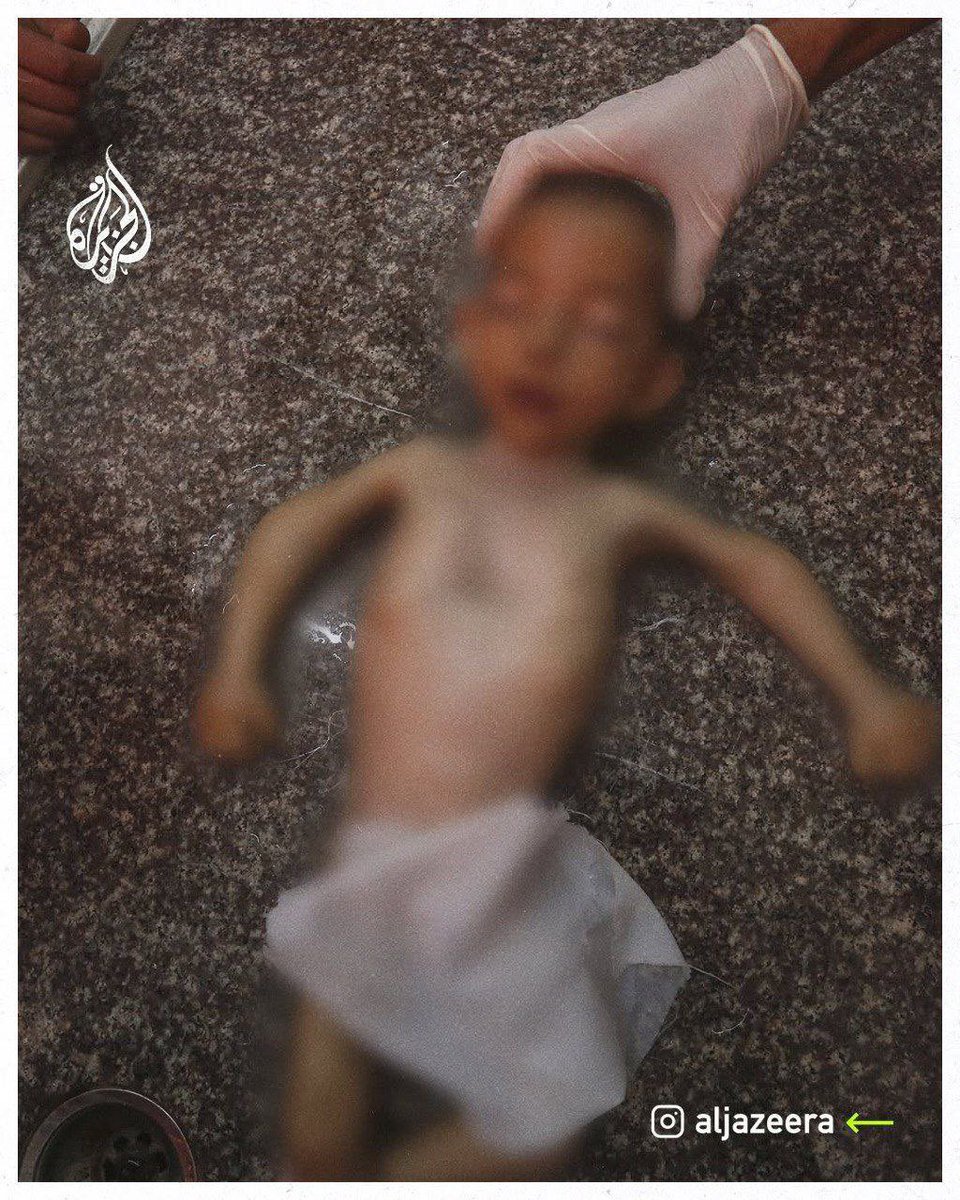 warfareanalysis's tweet photo. The death of 11-month-old Palestinian baby Uday Ahmed due to severe malnutrition and a lack of medicine, amid the continued siege by the Arab regimes and Israel.

Gaza’s Health Ministry says at least 60,000 children are at risk of severe health issues from malnutrition. https://t.co/ZhscI0p8Sd