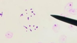 Mi nombre es Sara Errejón Redondo y presento mi fotografía de una Anafase II.  En ella se puede ver muy bien como las cromátidas hermanas se separan cada una a un polo. #BiologiaGeneralNHyD24_25 #practicameiosis <a href="/VegaGEscudero/">Vega García-Escudero</a> #lamejoranafaseII