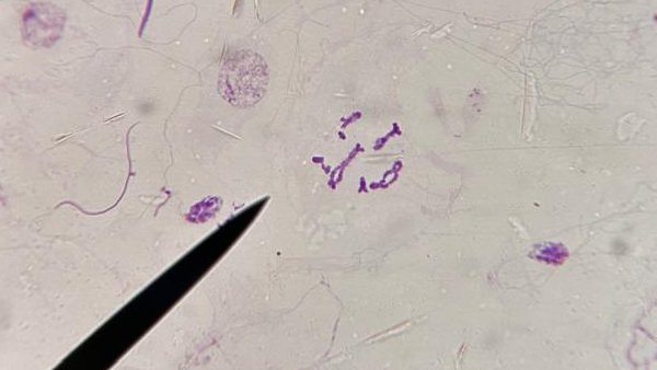 Soy Sara Errejón Redondo. Presento mi diplotena, 4ª etapa de la meiosis. Se reconoce por la separación de los cromosomas homólogos, excepto por los quiasmas, esenciales en la recombinación genética. #lamejordiplotena #BiologiaGeneralNHyD24_25 #practicameiosis <a href="/VegaGEscudero/">Vega García-Escudero</a>