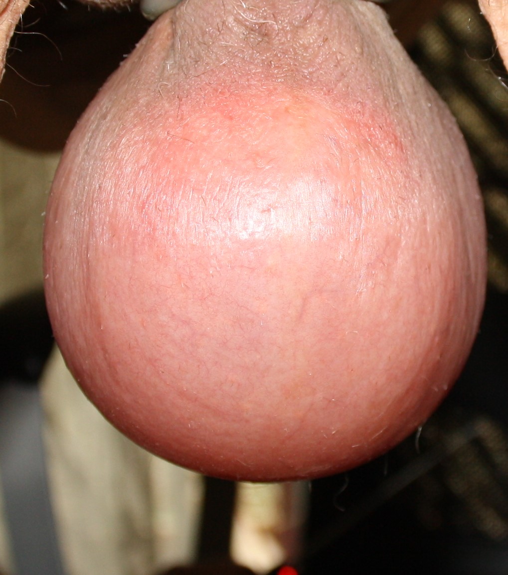 Latextraeger 🇨🇭 tweet media