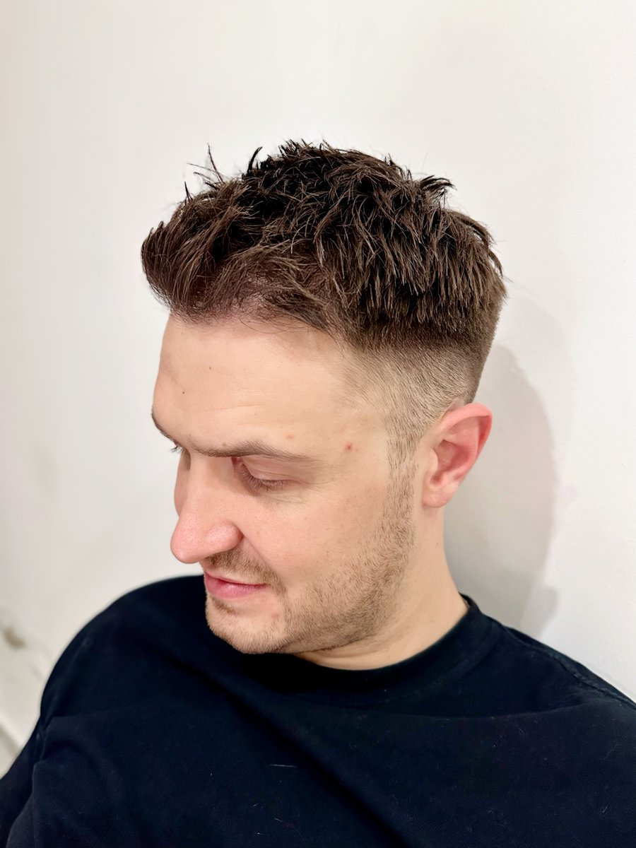 rain79050853's tweet photo. 🔴 BEFORE: Patchy hair, low confidence
🟢 AFTER: Thick hairline, natural results
He regained his hair (& smile) in 8 hours.
You can too. 
-
Consult me ​​about hair transplantation:         
WeChat: yhzfyl2005          
WhatsApp consultation: https://t.co/7Df8roApcx 
#hairtransplant #hairloss #thinninghair #yonghe #Malebaldness #hairstyle #hairgrowth #Hair