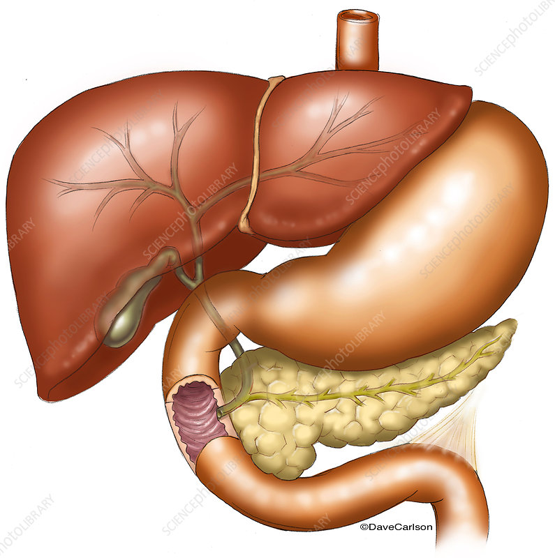 renu_offcl's tweet photo. #theworldliverday
#saveliver
Foods to avoid for fatty liver
1) high-fat foods (saturatedfats like red meat and transfat
2) salt
3) sugary foods and beverages like fruits juices
4) high-fructose corn syrup
5) fried foods
6) processed foods
7) refined grains ( white bread,white rise,and pasta
8) raw or under cooked shellfish
9) alcohol