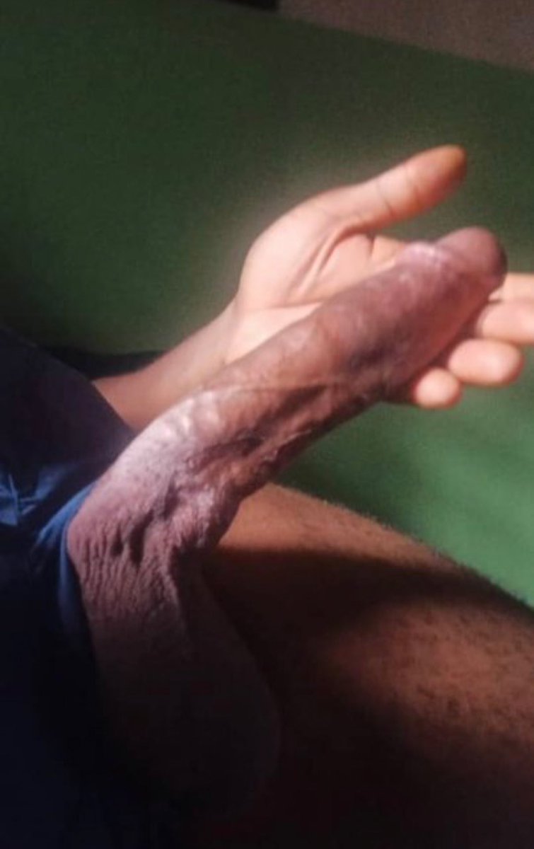 pussy medicine 🍆💯 tweet media