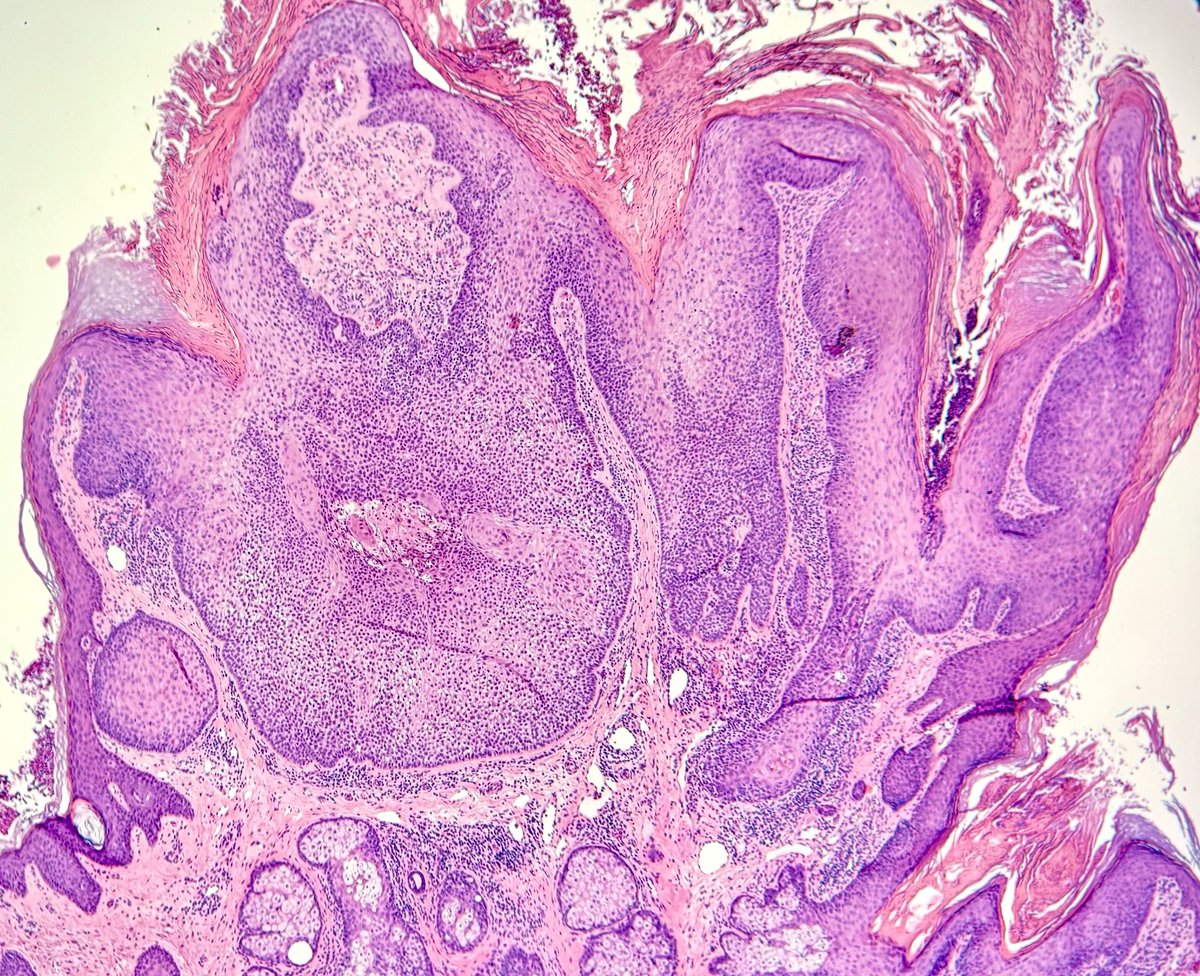 Francesco Fortarezza tweet media